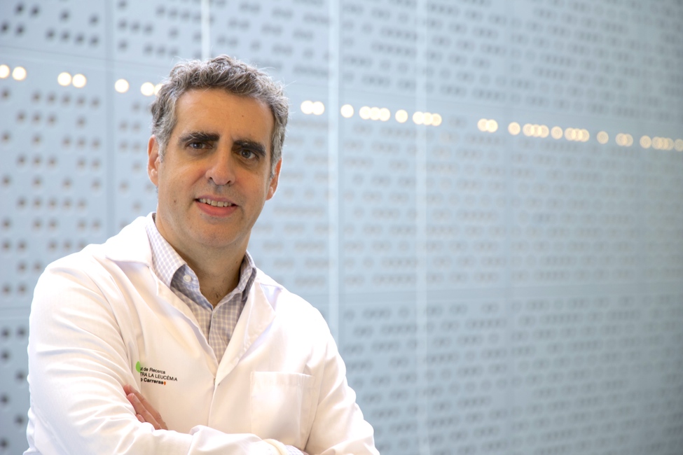 Epigenetics predicts the aggressiveness of Burkitt Lymphoma, a common paediatric tumour in developing countries